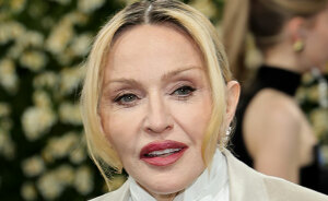 People Are “Stressed” After Spotting Madonna Lost One Of Her Famous Face Features At The Met Gala